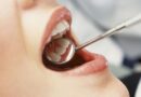 Cavities: Why They’re the Most Common Dental Problem and How To Prevent Them