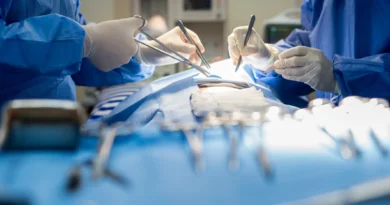 How to Choose a Vascular Surgeon: Tips and Considerations
