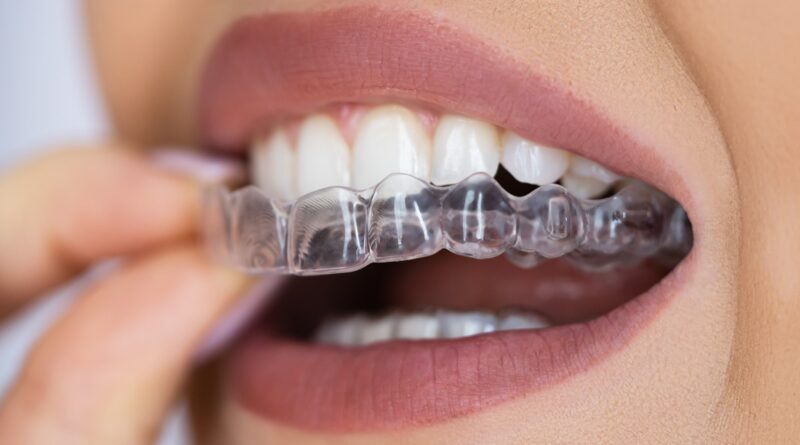 invisible dental braces