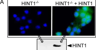 Antibody Validation