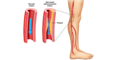 Vascular Surgeons