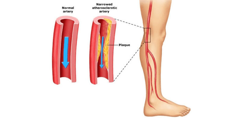 Vascular Surgeons