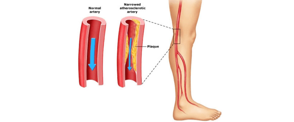 Vascular Surgeons