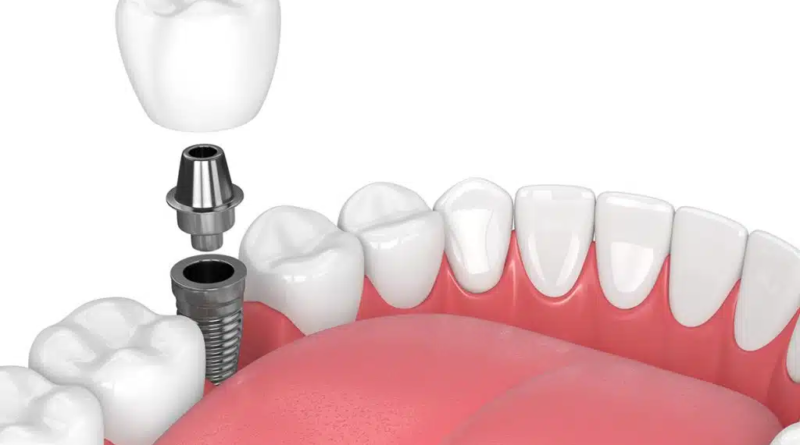 Periodontists