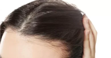 hair fall treatment