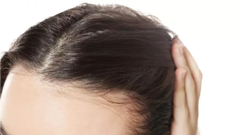 hair fall treatment