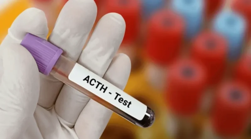 ACTH stimulation