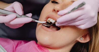 Porcelain veneers Perth