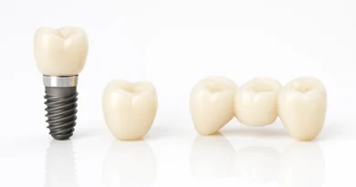 Affordable Dental Implants Singapore